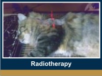 radiotheraphy