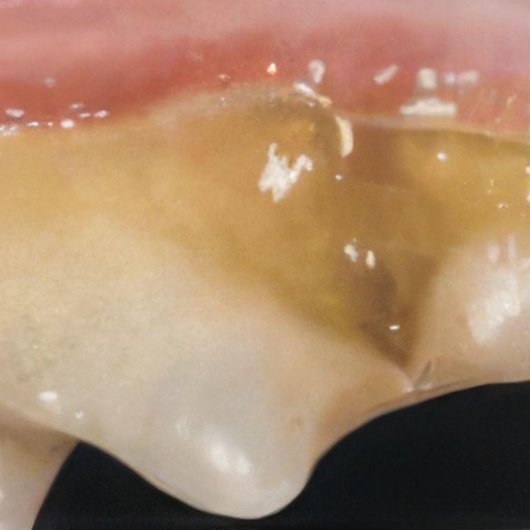 feline dental disease with mild plaque and gingivitis.
