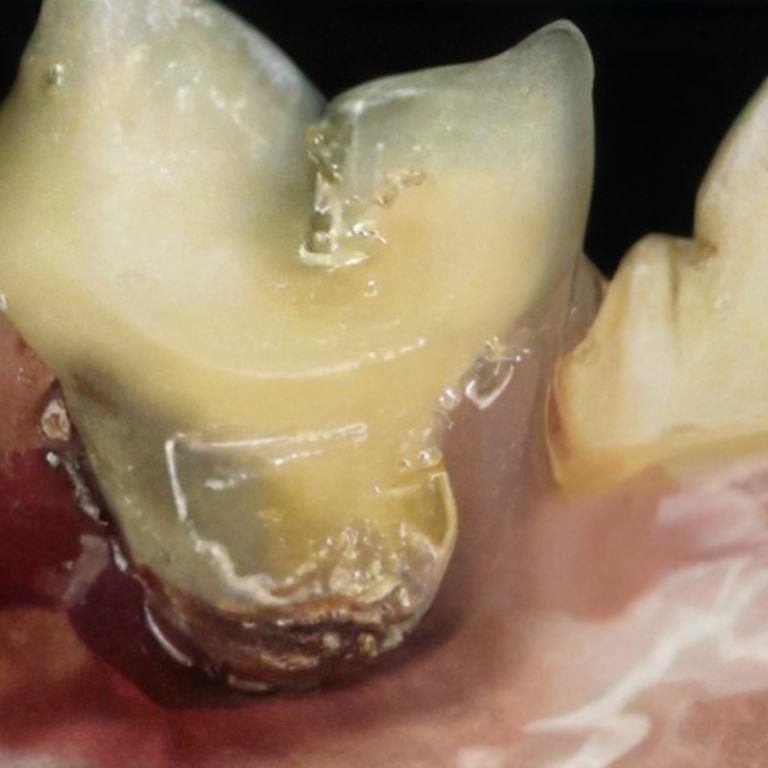 feline periodontal disease with severe tooth damage.