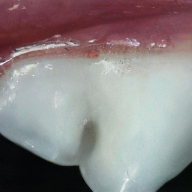 canine dental health with healthy teeth and gums.