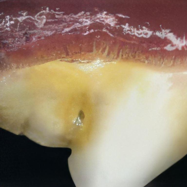 canine dental disease with mild plaque and gingivitis.