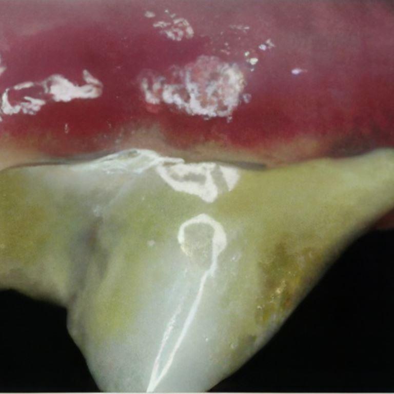 canine periodontal disease with tartar build up.
