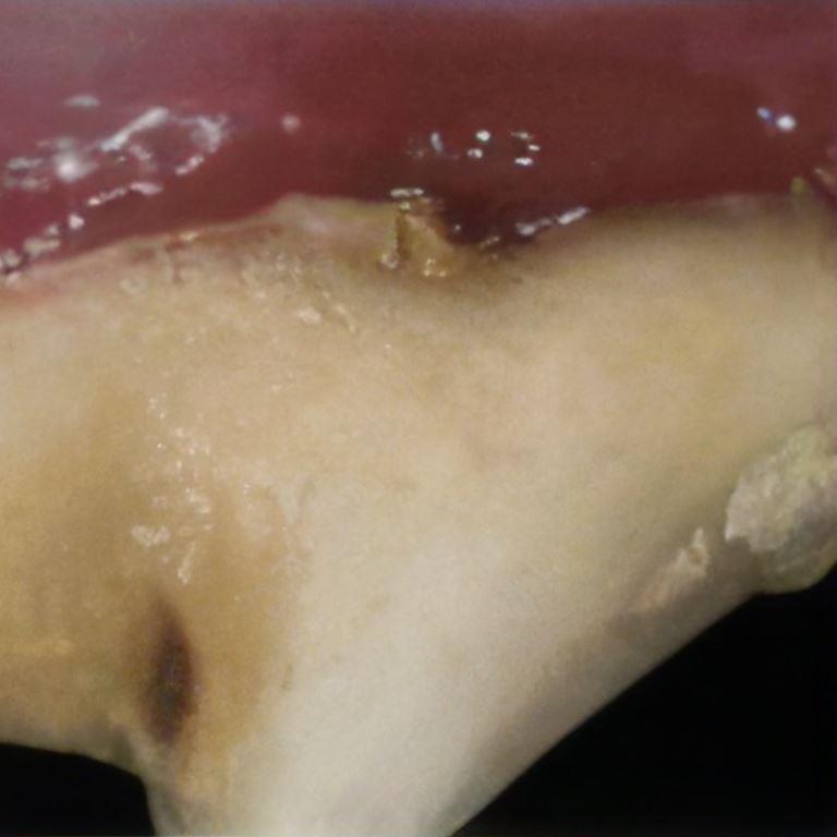 canine periodontal disease with advanced gum disease.